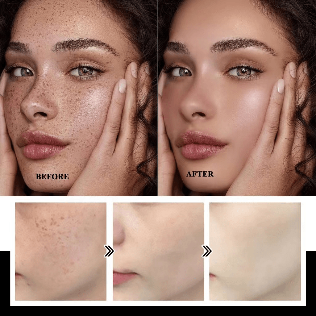 Hymey's Nicotinamide Anti Freckle Face Serum - 30ml