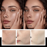 Hymey's Nicotinamide Anti Freckle Face Serum - 30ml