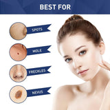 Jaysuing Skin Tag Remover - 20ml