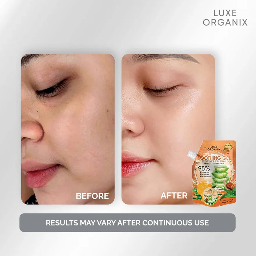 Luxe Organix Aloe Vera & Snail Soothing Gel - 100ml