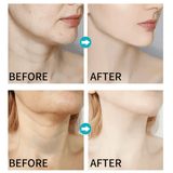 Dr.Rashel 5D Hyaluronic Acid Youth Revitalizing Neck Cream - 120g - Pinoyhyper