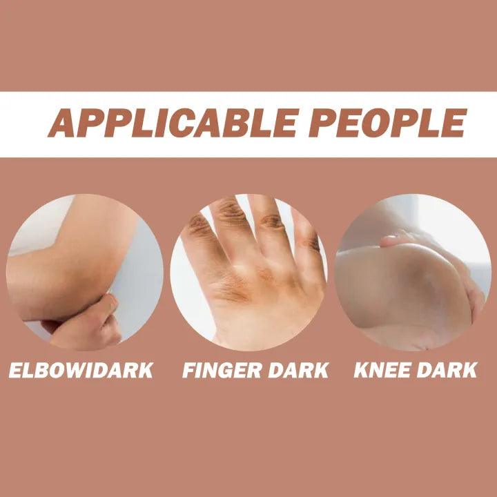 Eelhoe Knees and Elbows Whitening Cream - 50g - Pinoyhyper