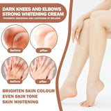 Eelhoe Knees and Elbows Whitening Cream - 50g - Pinoyhyper