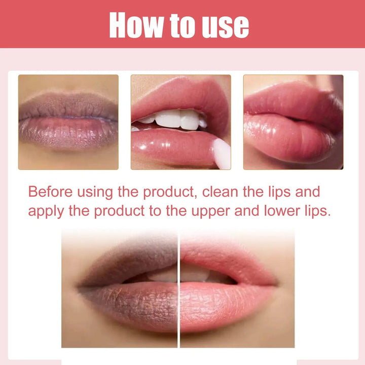 Eelhoe Lip Lightening Cream - 30g - Pinoyhyper