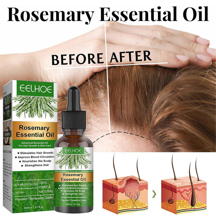 EELHOE Rosemary Oil for Hair Growth - Pinoyhyper