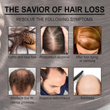 EELHOE Rosemary Oil for Hair Growth - Pinoyhyper