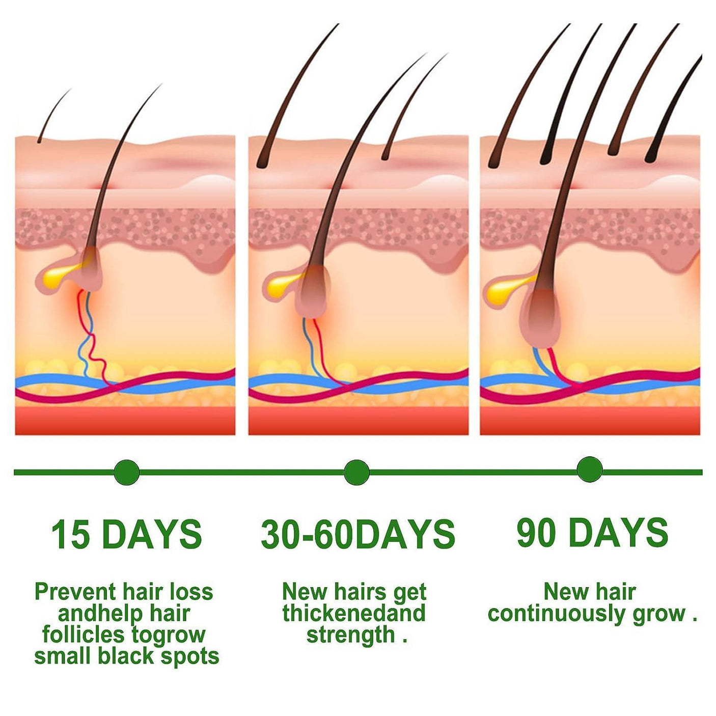 EELHOE Rosemary Oil for Hair Growth - Pinoyhyper
