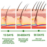 EELHOE Rosemary Oil for Hair Growth - Pinoyhyper
