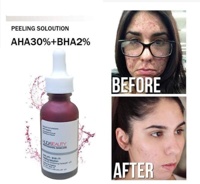 Huda Beauty AHA 30%+BHA 2% Peeling Solution - Pinoyhyper