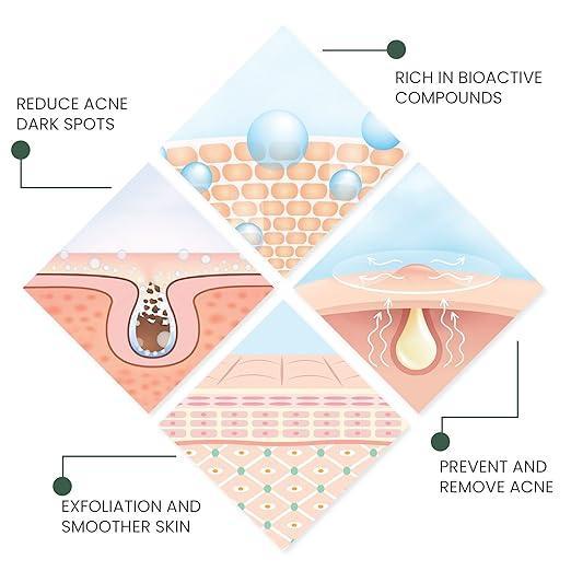 Jaysuing Back Acne Treatment Spray 120ml Pinoyhyper