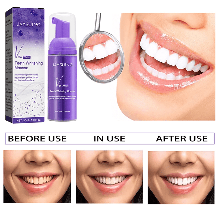 Jaysuing Teeth Whitening Mousse - 50ml - Pinoyhyper