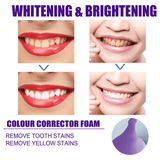 Jaysuing Teeth Whitening Mousse - 50ml - Pinoyhyper