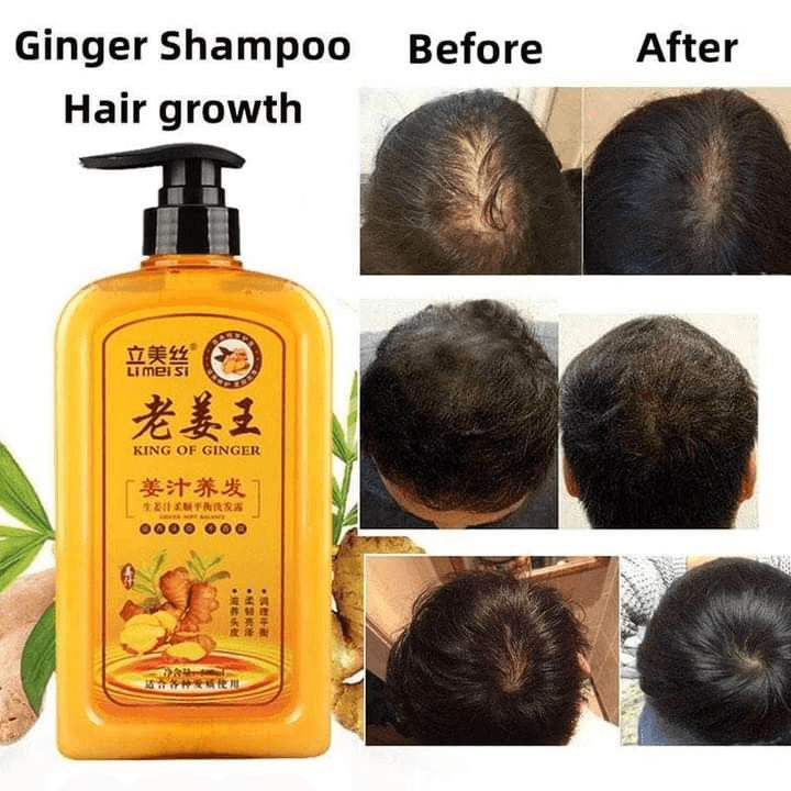 Li Mei Si King Of Ginger Shampoo - 500ml - Pinoyhyper