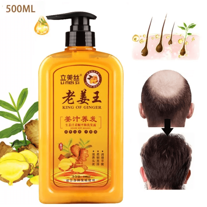 Li Mei Si King Of Ginger Shampoo - 500ml - Pinoyhyper