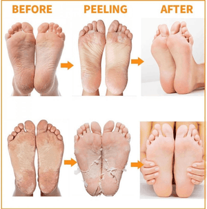 MBeauty Exfoliating Magic Foot Socks 1 Pair - Pinoyhyper