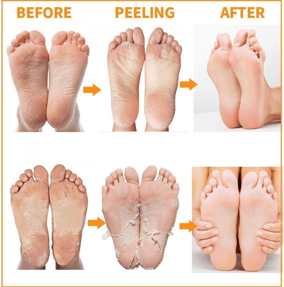 MBeauty Exfoliating Magic Foot Socks 1 Pair - Pinoyhyper