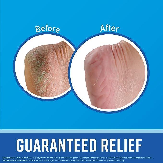 O'keeffe's for Healthy Feet Cream - 76g - Pinoyhyper