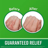 O'keeffe's for Working Hands Cream - 76g - Pinoyhyper