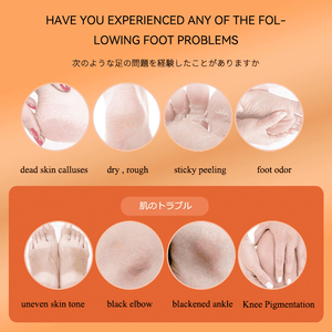 Orange Oil Foot Peeling Spray - 110ml - Pinoyhyper