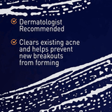 PanOxyl Acne Creamy Wash Benzoyl Peroxide 4% Daily Control - 170g - Pinoyhyper