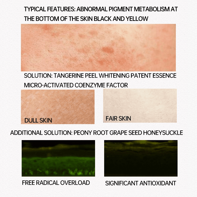 Pei Mei Pink Essence For Lips,Areolas & Private Parts - 30g - Pinoyhyper