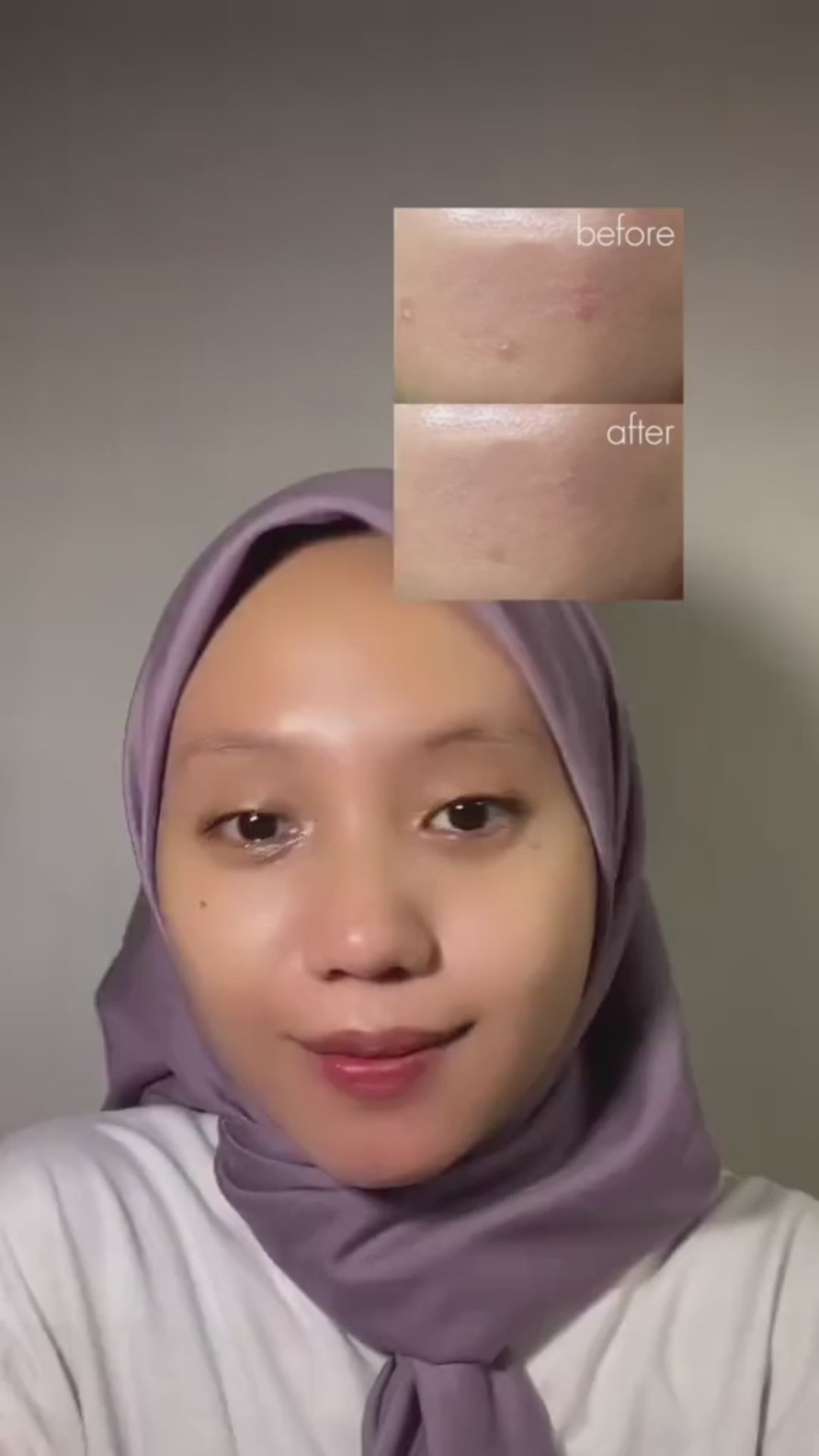 مجموعة تجربة الريتينول المكثفة من Some By Mi