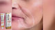 OUHOE Botox Bee Venom Wrinkle Cream - 20g