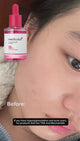 Medicube TXA Niacinamide 15 Serum - 30ml