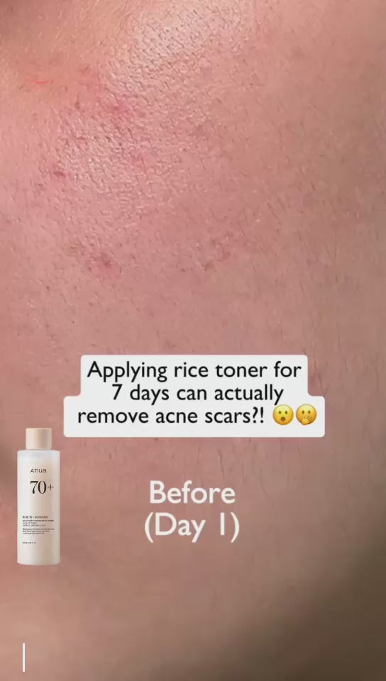 Anua Rice 70 Glow Milky Toner - 250ml
