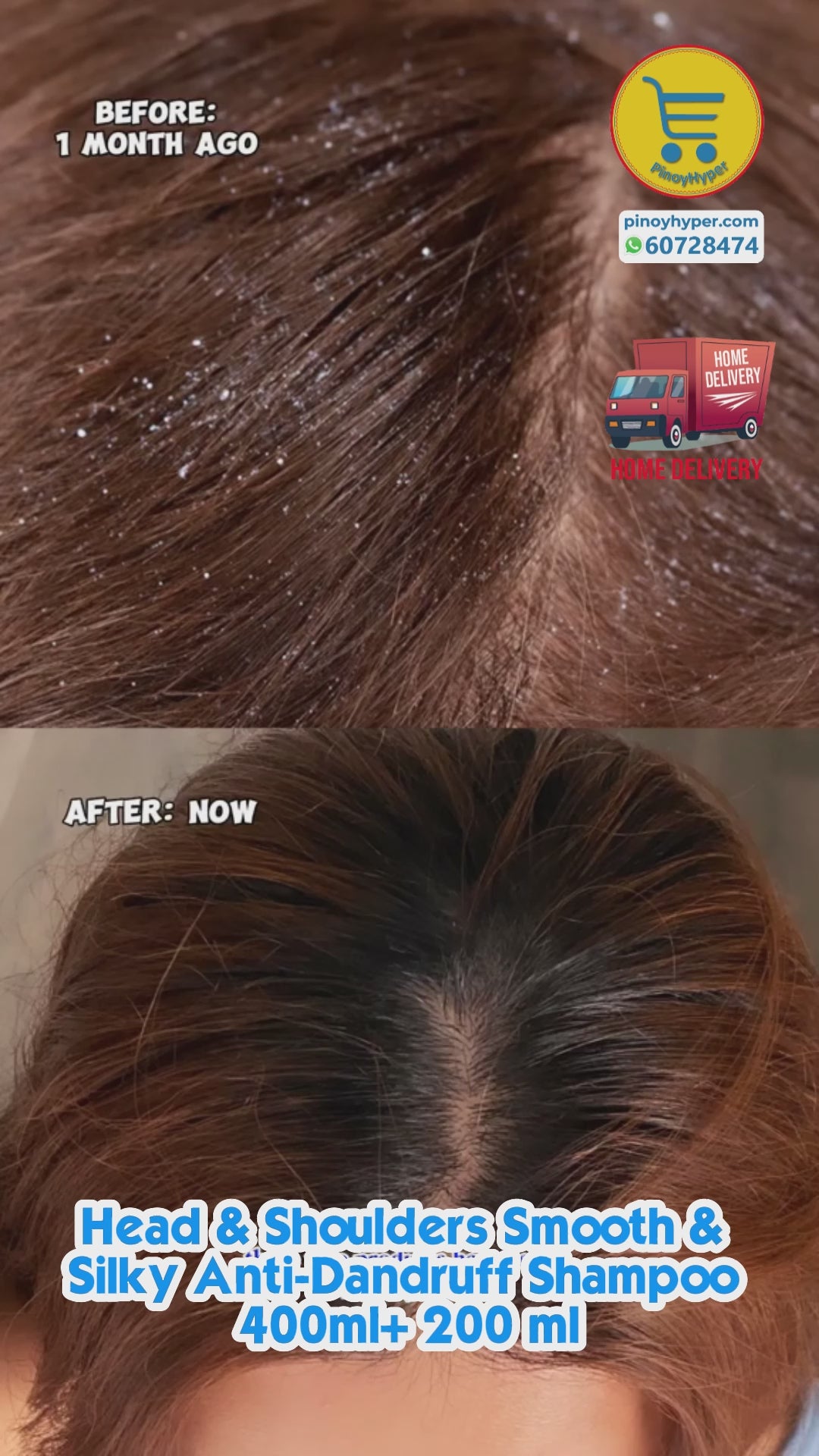 Head & Shoulders Smooth & Silky Anti-Dandruff Shampoo 400ml+ 200 ml