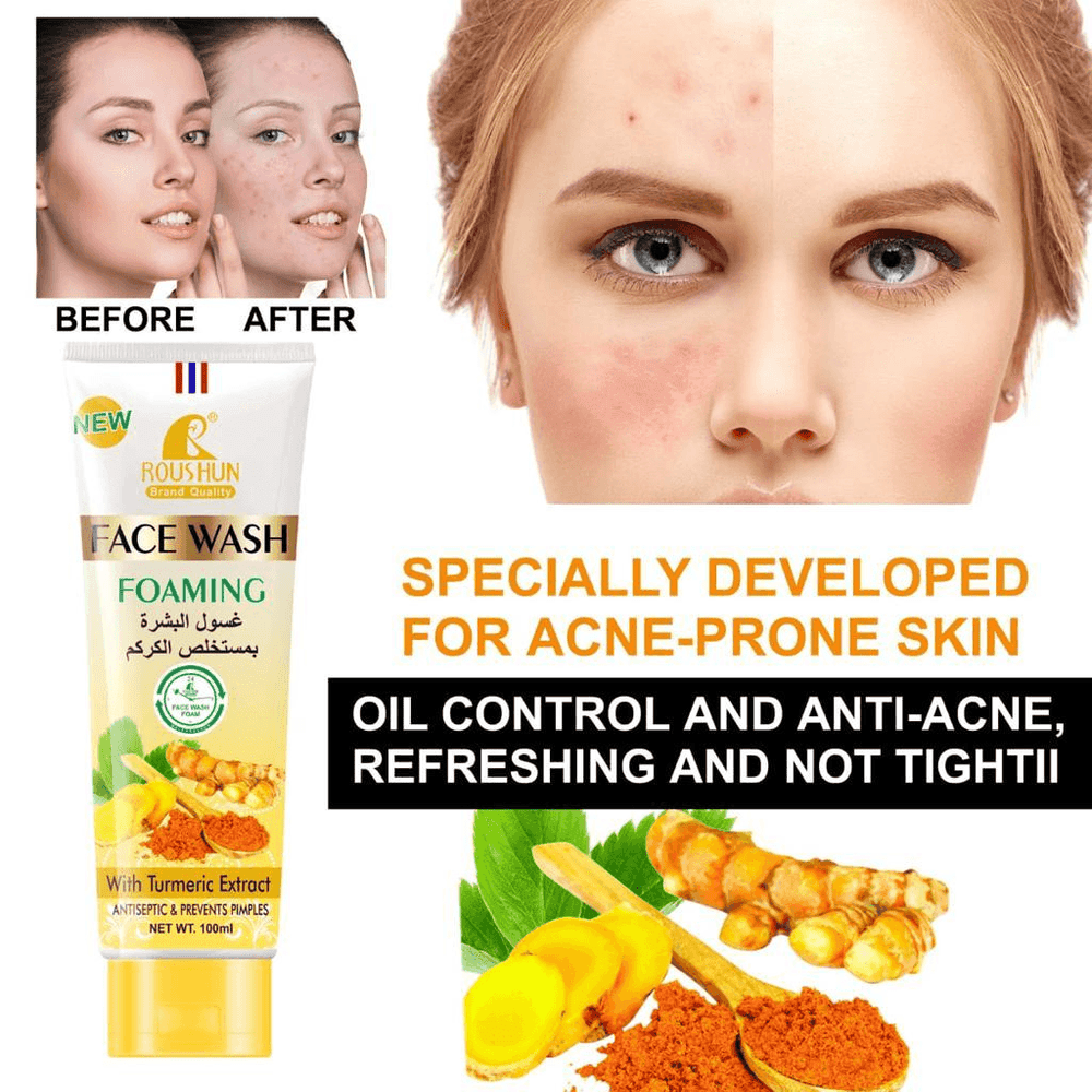 Roushun Turmeric Foaming Face Wash - 100ml – Pinoyhyper