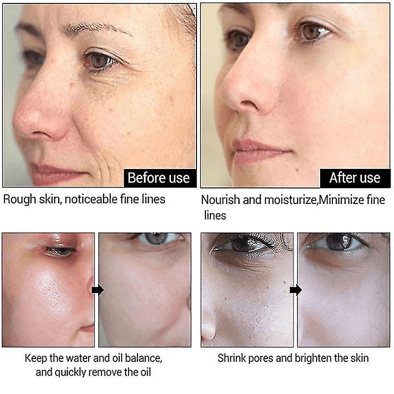 Sadoer Retinol Extract Eye Serum - 15ml - Pinoyhyper