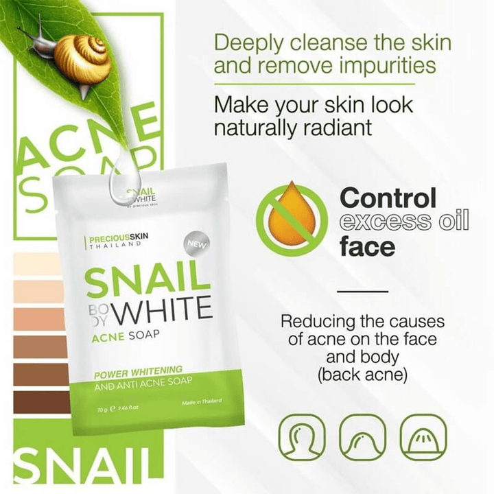 Snail White Acne Soap - 70g - Pinoyhyper