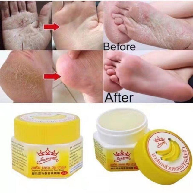 Supreme Banana Balm for Rough & Dry Skin - 20g - Pinoyhyper