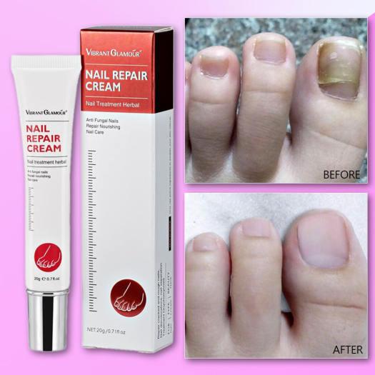 Vibrant Glamour Nail Repair Cream Anti Fungal Nails Repair Nourishing- 20g - Pinoyhyper