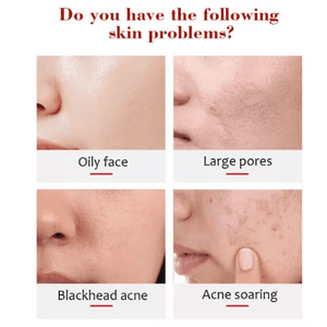 Aichun Beauty Papaya Soft Clean Peeling Gel Face & Body - 100g - Pinoyhyper