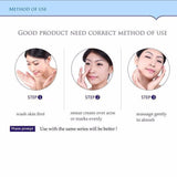Bioaqua face cream skin care anti acne treatment cream 30g -100% ORIGINAL - Pinoyhyper