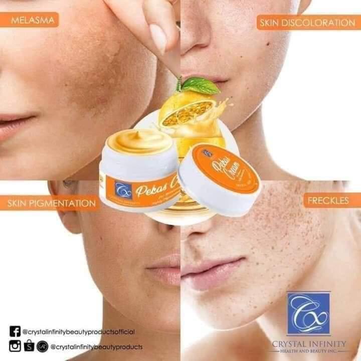 Crystal Infinity Pekas Cream 15g - Pinoyhyper