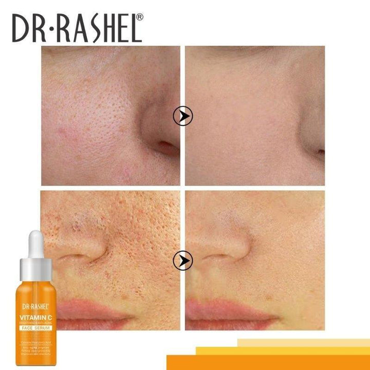 Dr.Rashel Vitamin C Brightening Anti Aging Face Serum - 50ml - Pinoyhyper