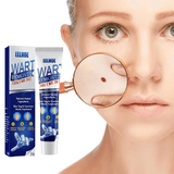 EELHOE Wart Remover Ointment - 20g - Pinoyhyper