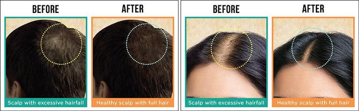 Indulekha Hair Oil, Reduces Hair Fall And Grows New Hair, 100% Ayurvedic Oil - Pinoyhyper