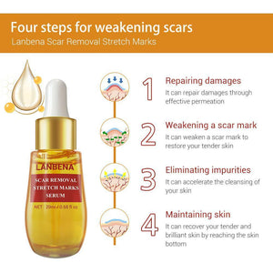 Lanbena Scar and Stretch Mark Removal Serum - 20 ml - Pinoyhyper