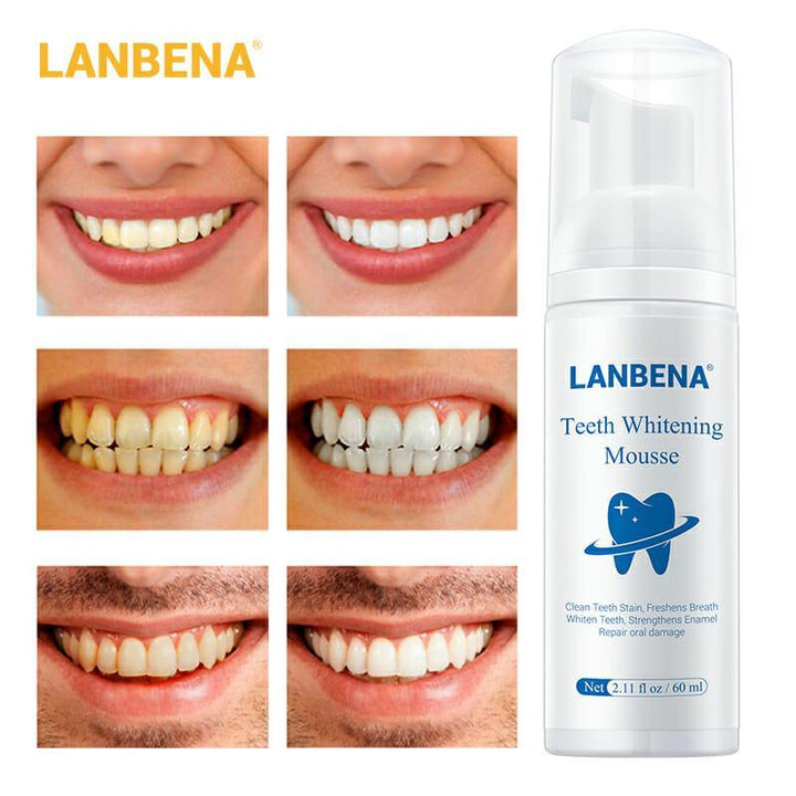 Lanbena Teeth Whitening Mousse - 60ml - Pinoyhyper