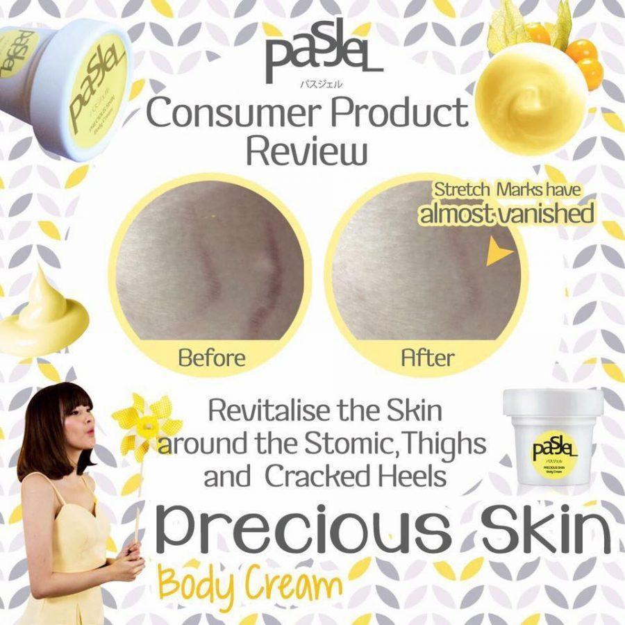 Pasjel Cream For Stretch Marks And Scar Removal Cream 50g - Pinoyhyper