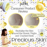 Pasjel Cream For Stretch Marks And Scar Removal Cream 50g - Pinoyhyper