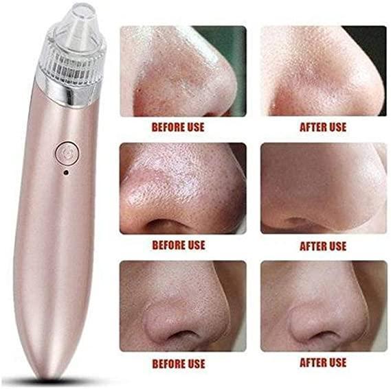 Portable Ultrasonic XN-8030 Electric Blackhead Vacuum Cleaner - Pinoyhyper