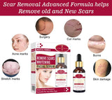 Remove Scars Whitening Facial Serum 30ml - Aichun Beauty - Pinoyhyper