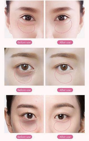 Rose Berry Roselle Gel Eye Mask - 60pcs - Pinoyhyper