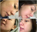 Rosmar Instant Whitening Bleaching Whipped Scrub Spf 60 - 300gm - Pinoyhyper