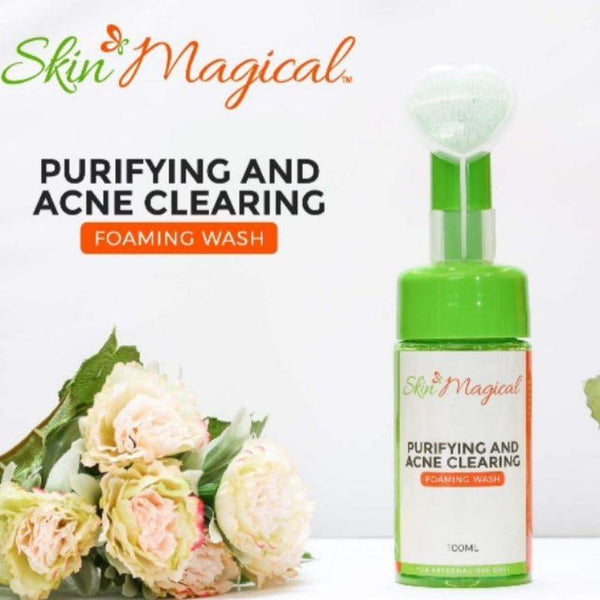 Skin Magical - Purifying and Acne Clearing Foam Wash - Pinoyhyper